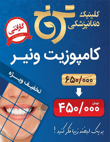 بهترین تخفیفات دندانپزشکی | تخفیف دندانپزشکی در بهترین کلینیک دندانپزشکی در شرق تهران